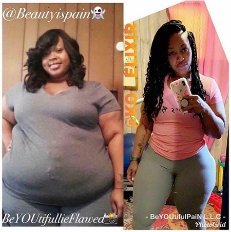 Is Tokyo Vanity Unbelievable Weight Loss Transformation Real Or Scam ...