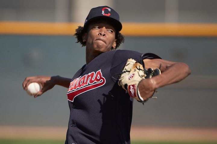 Triston McKenzie