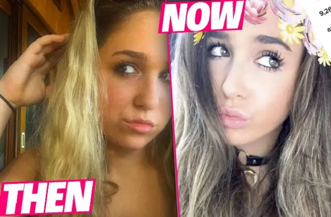 ariana biermann before after
